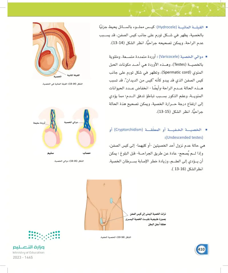 13-5 الأمراض الأكثر شيوعاً في الجهاز التناسلي