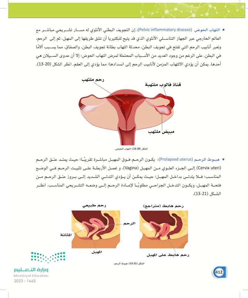 13-5 الأمراض الأكثر شيوعاً في الجهاز التناسلي