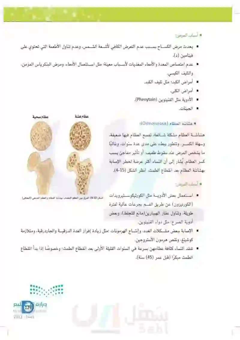 4-4 وظائف الهيكل العظمي والأمراض المتعلقة به