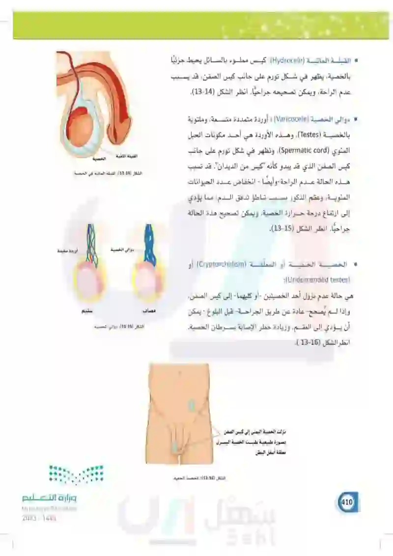 13-5 الأمراض الأكثر شيوعاً في الجهاز التناسلي