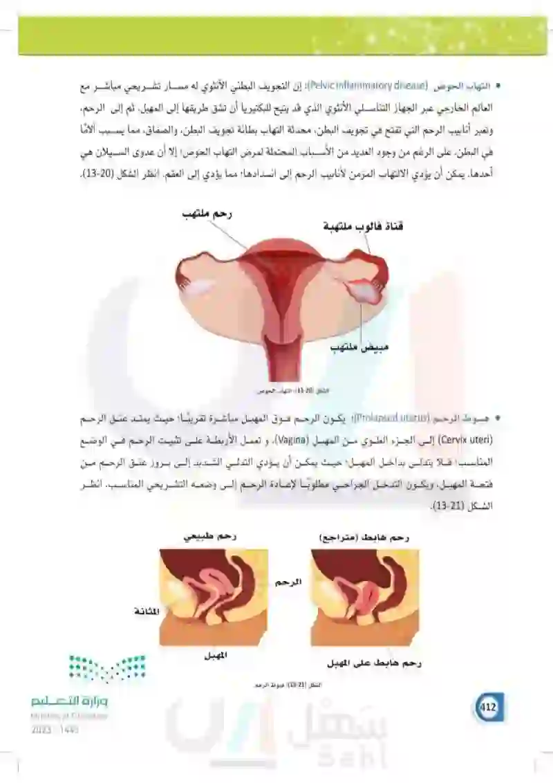 13-5 الأمراض الأكثر شيوعاً في الجهاز التناسلي